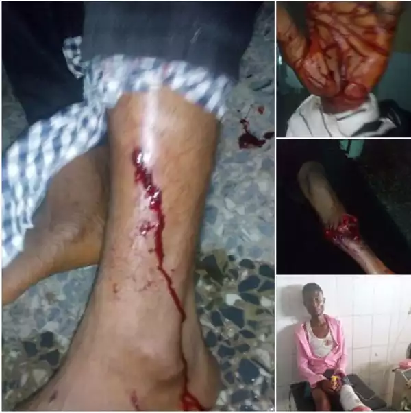 Graphic Photos Security Operatives Allegedly Shoot Students During Protest In Calabar